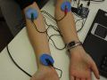 three electrode patches placed on arms