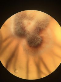 Armillaria Gallica sample